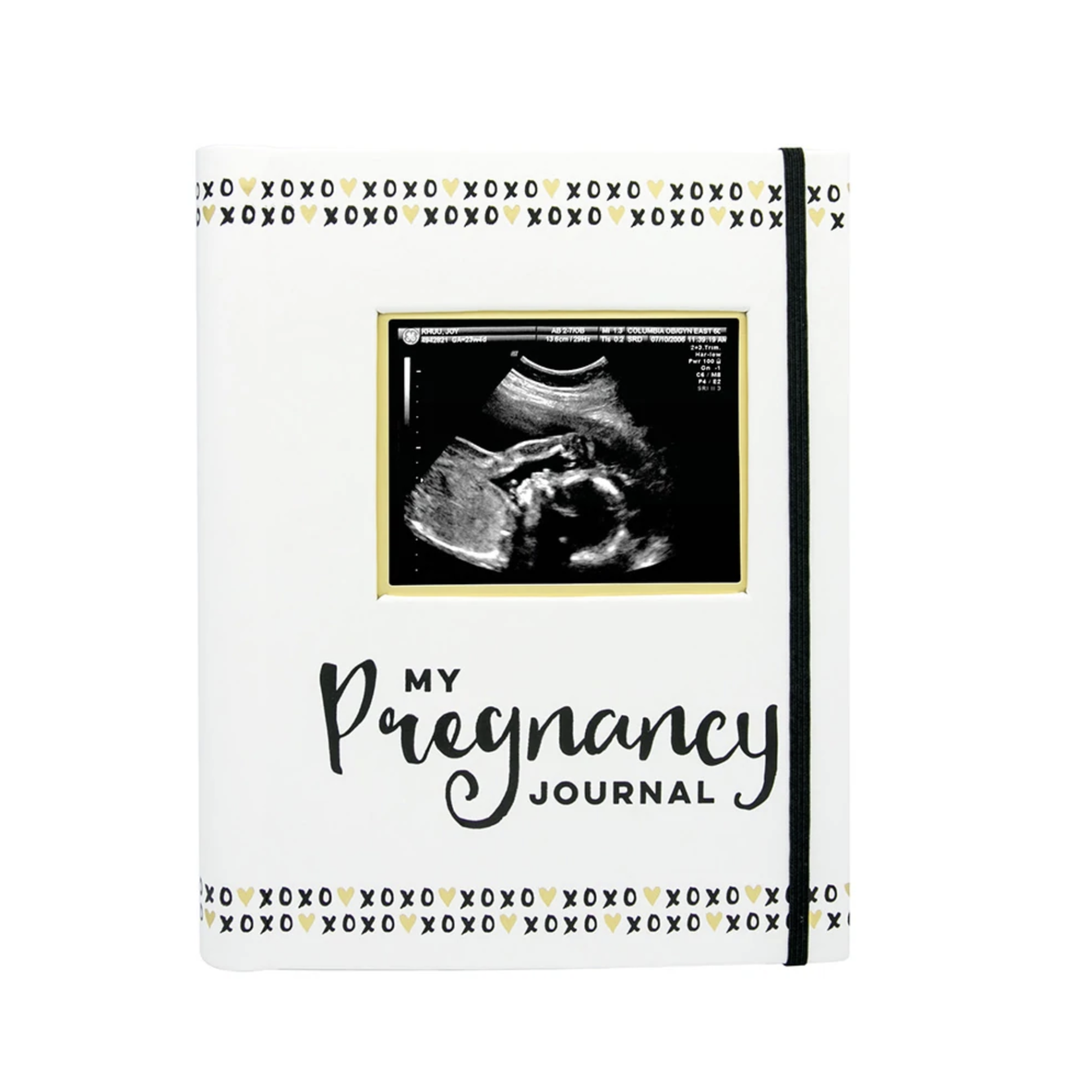 Pearhead Pregnancy Journal - Black, White & Gold