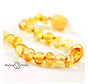 Healing Amber 5.5” Bracelet Circle Clasp Gold