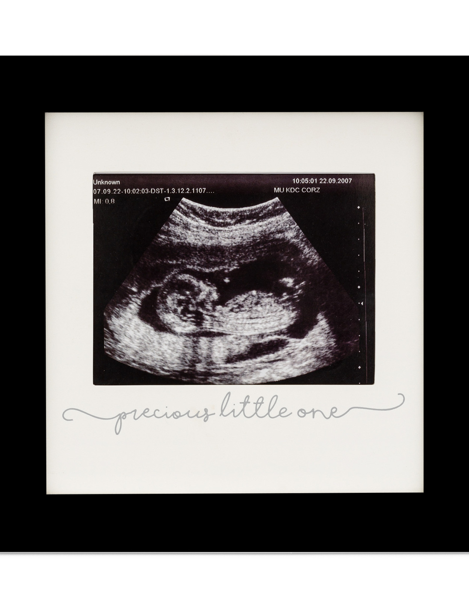 Baby Sonogram Picture Frame Bellies2Babies
