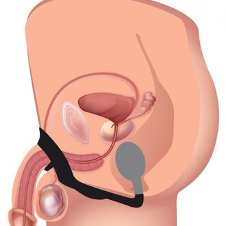 Alpha-Pro Alpha-Pro 10X P-Bomb Cock & Ball Ring w/ Plug