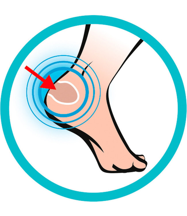 SIDAS FOOT PROTECTORS (5-PACK)