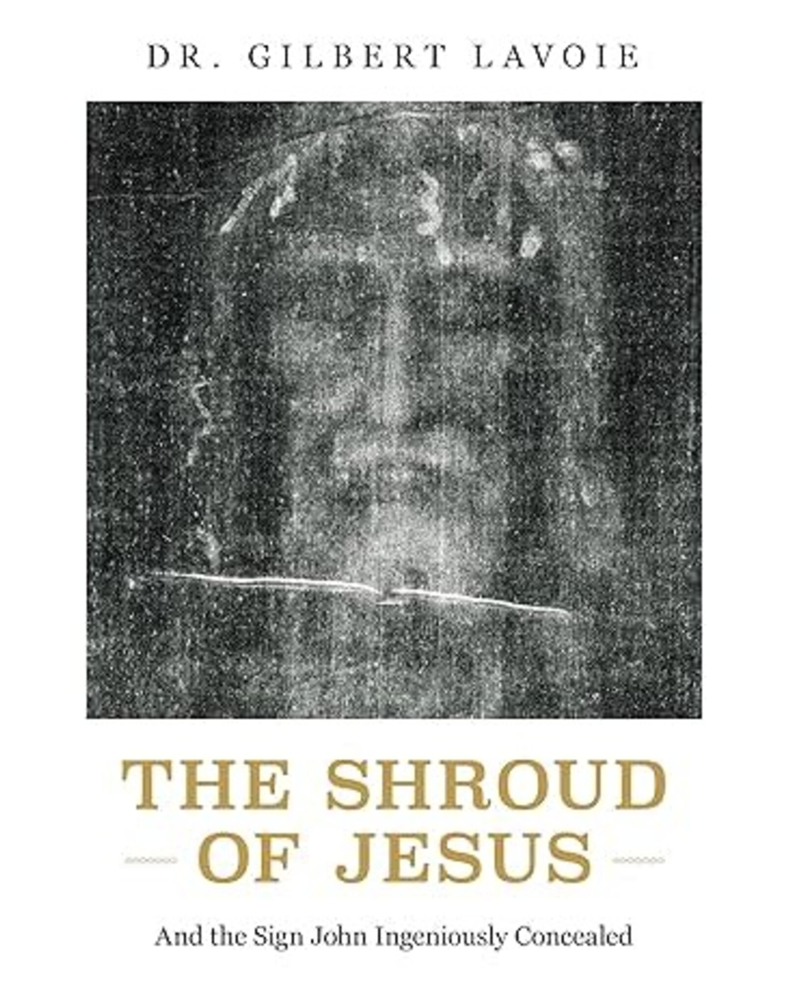 Sophia Institue Press Shroud of Jesus: and the Sign John Ingeniously Concealed