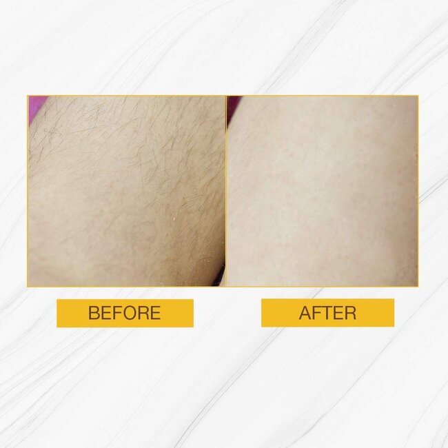 GiGi - Hair Removal Strips For Body - 12 strips