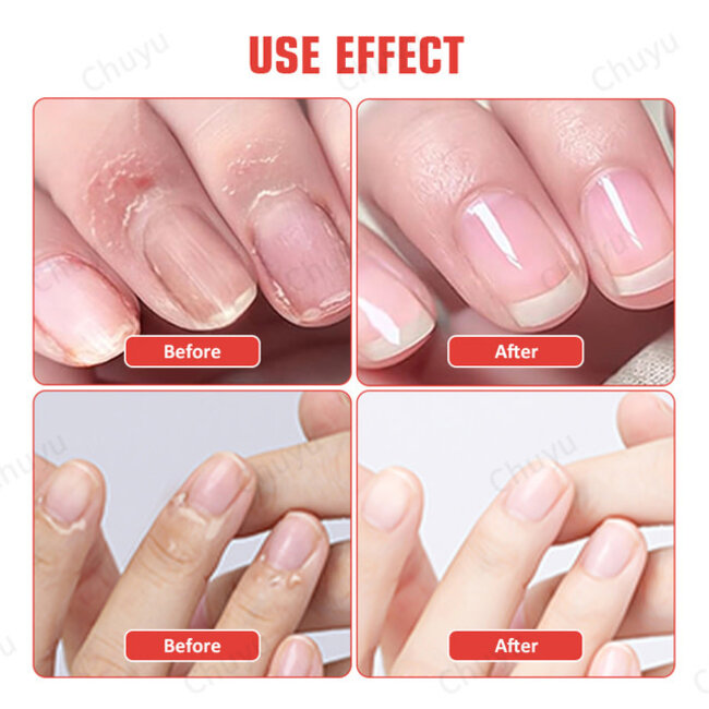 Beacysw - Cuticle Remover - 4in1 - Lavender