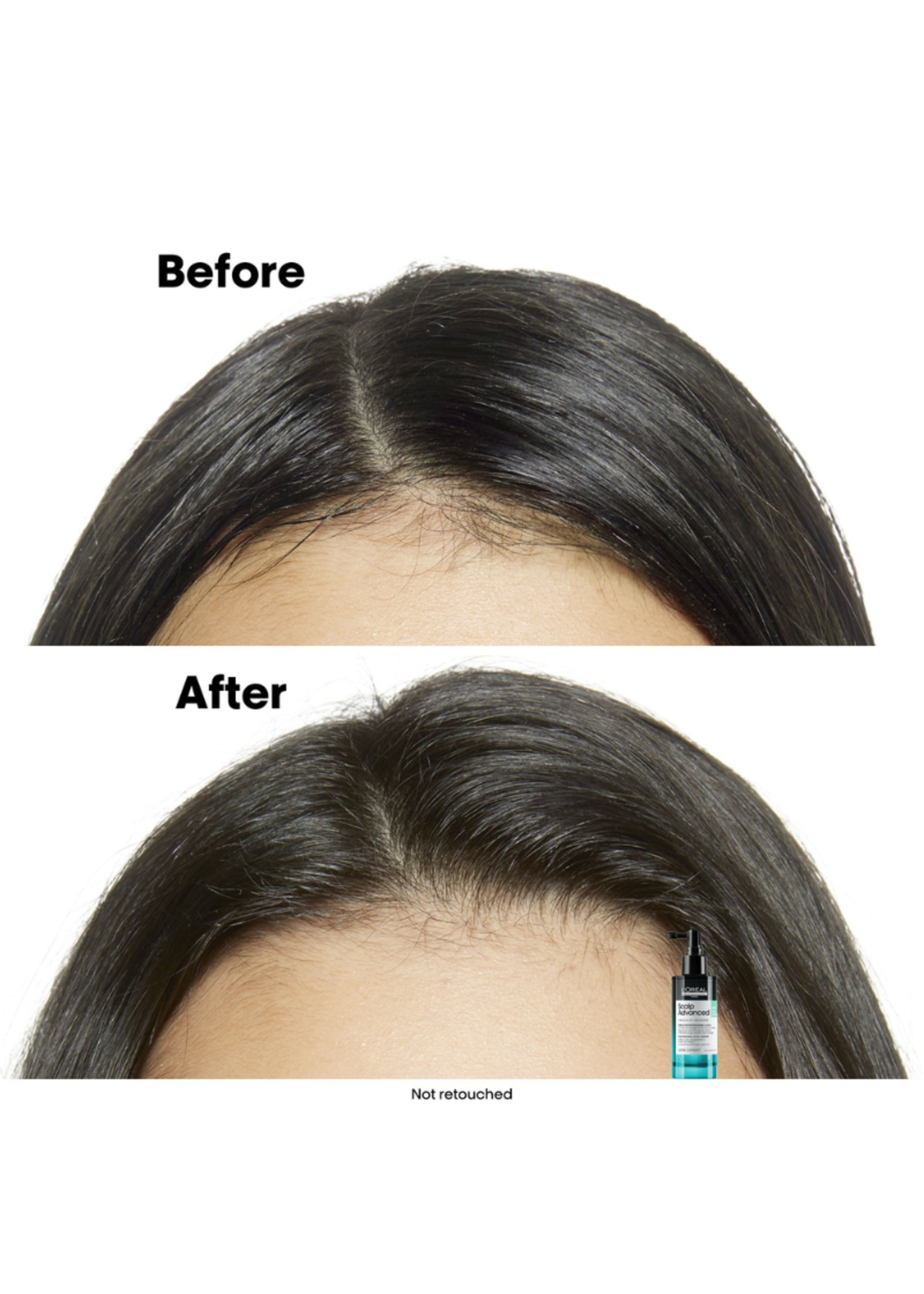 Loreal Professional Loreal Serie Expert Scalp Advanced Anti-Oiliness Serum 90ml