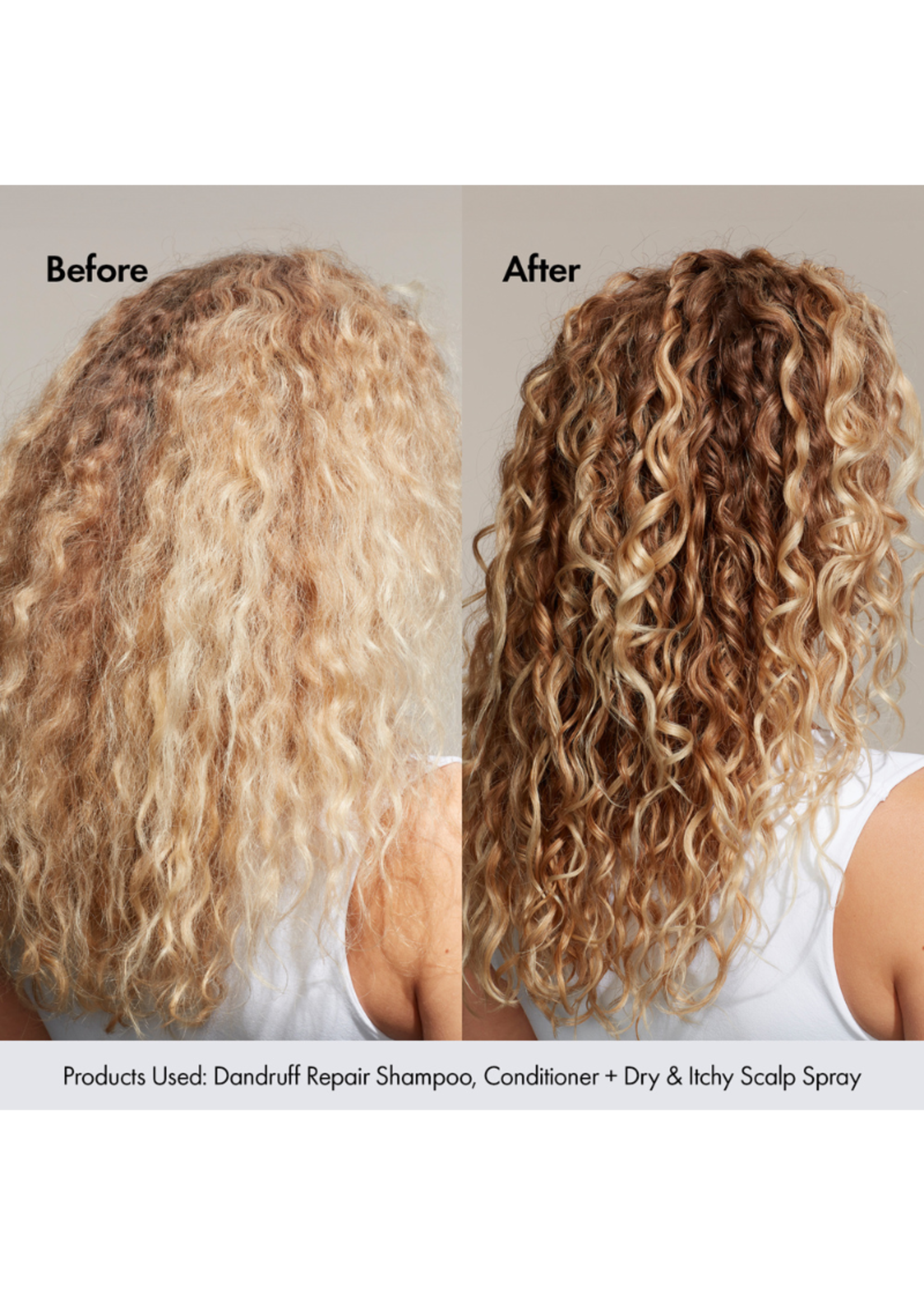 Bondi Boost Dry + Itchy Scalp Spray 125ml EV Hair and Beauty