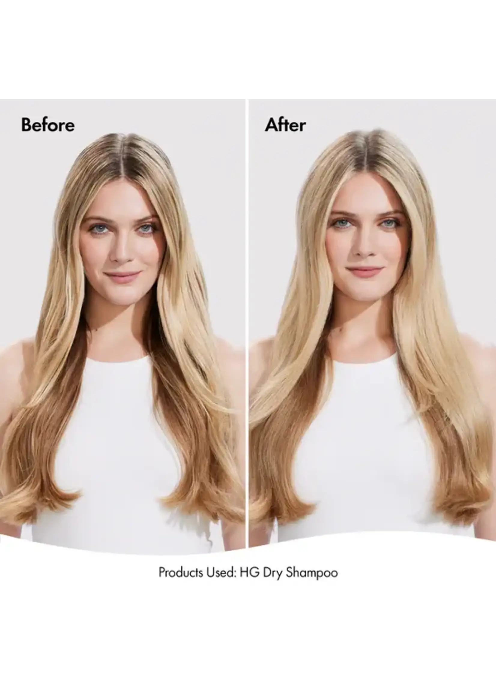 Bondi Boost Bondi Boost Hair Growth Dry Shampoo 200ml