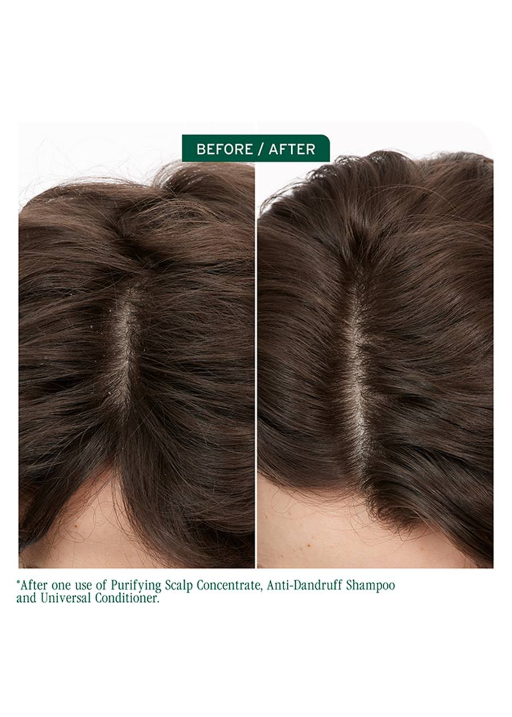 Biolage Biolage Scalp Sync Anti-Dandruff Shampoo 400ml