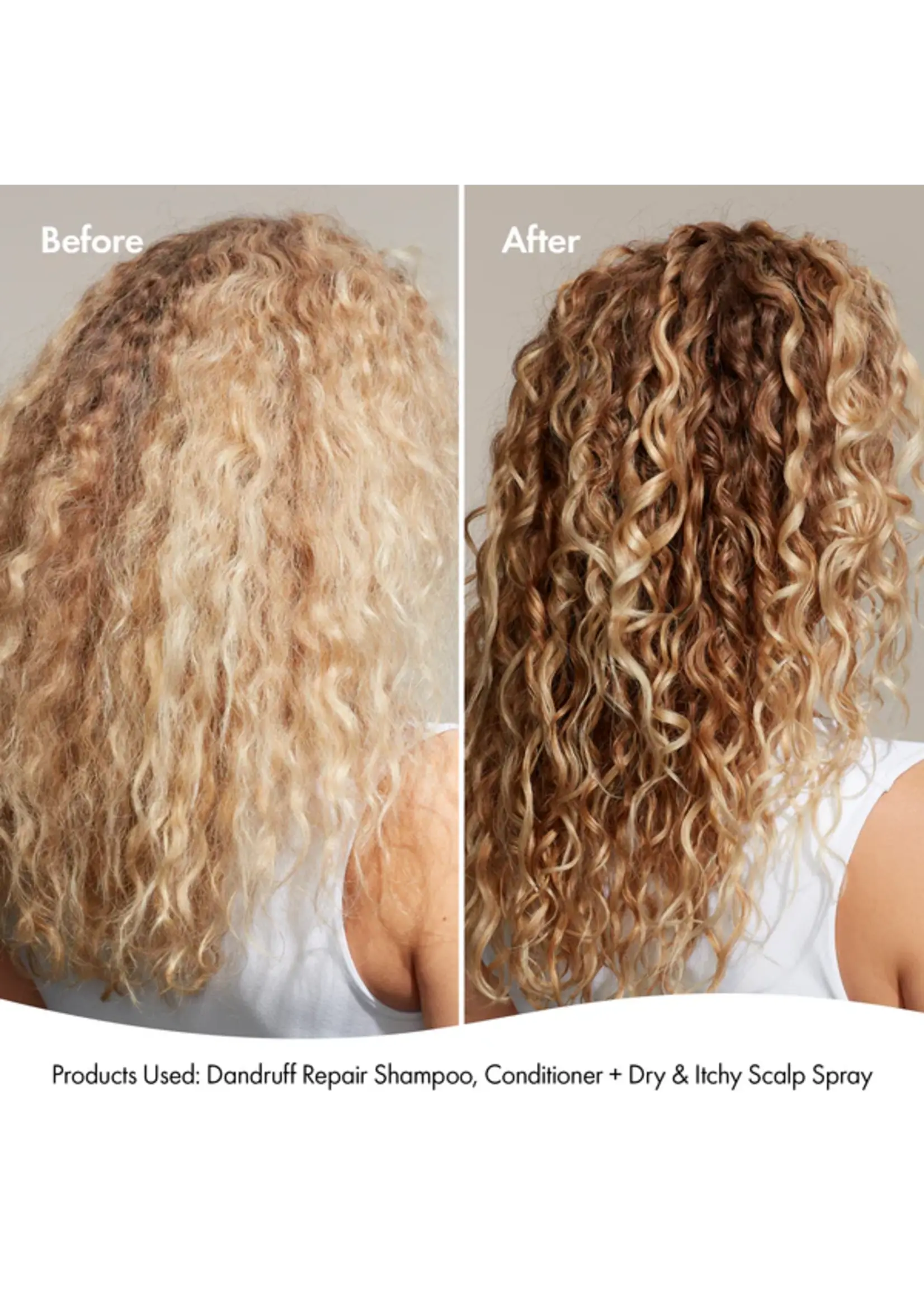 Bondi Boost Bondi Boost Dandruff Repair Conditioner 300ml