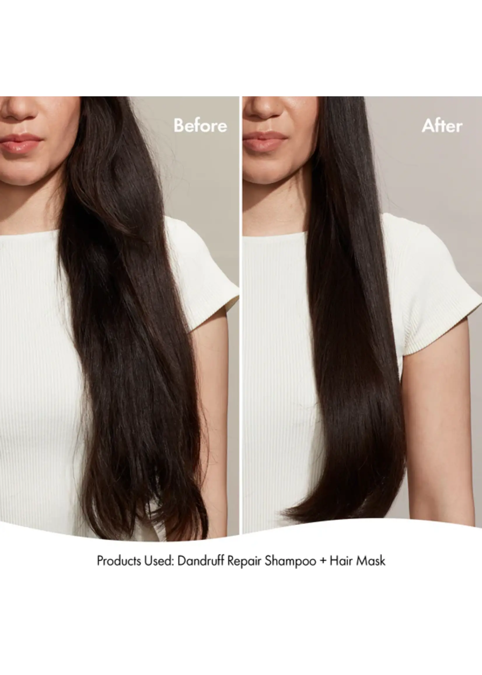 Bondi Boost Bondi Boost Dandruff Repair Shampoo 300ml