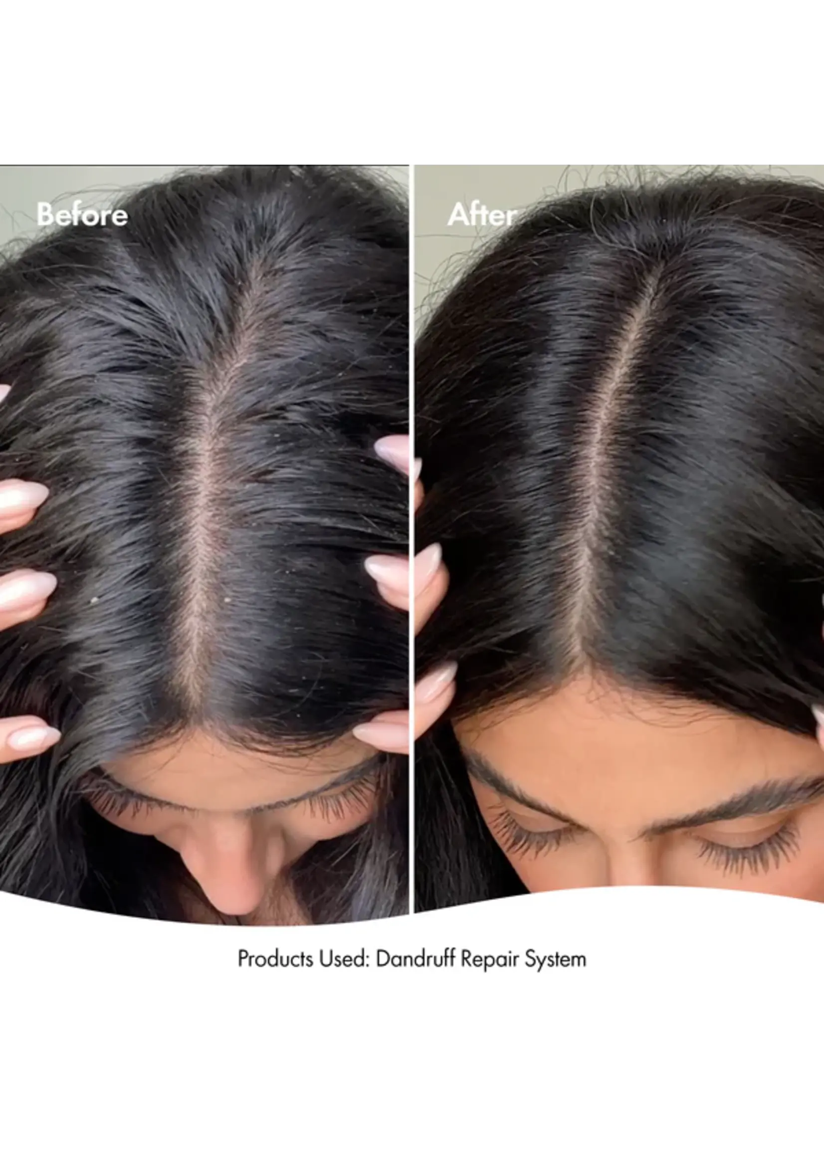 Bondi Boost Bondi Boost Dandruff Repair Shampoo 300ml