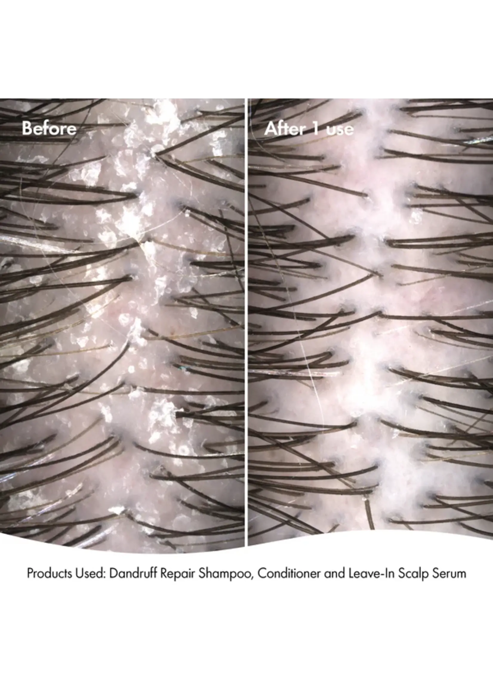 Bondi Boost Bondi Boost Dandruff Repair Shampoo 300ml