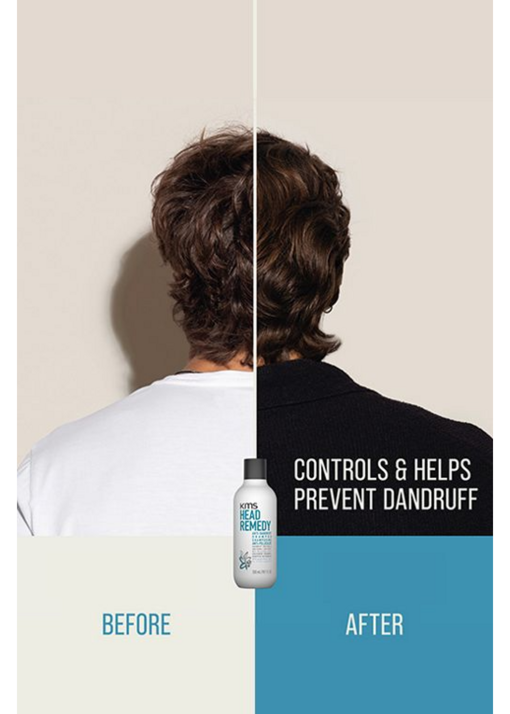 KMS KMS Headremedy Anti-Dandruff Shampoo 300ml