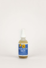 Golden Poppy Herbs Balancing (Oily/Acne) Skin Facial Toner 2oz