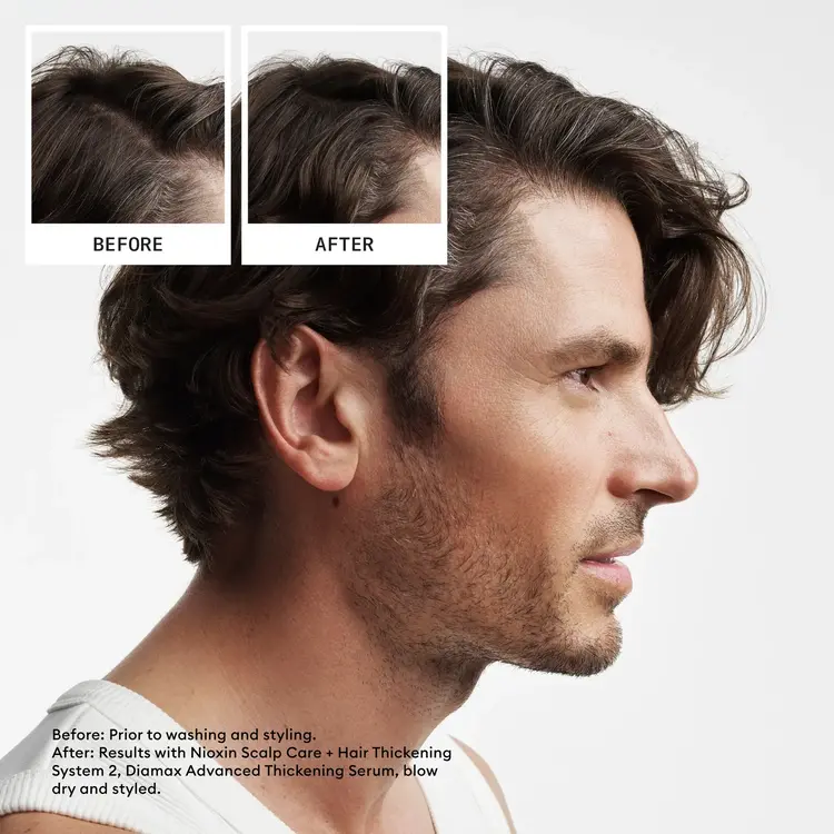 NIOXIN Pro Clinical NIOXIN - SYSTÈME | 2 Cheveux Naturels - Chute Avancée | KIT | Trousse de Départ