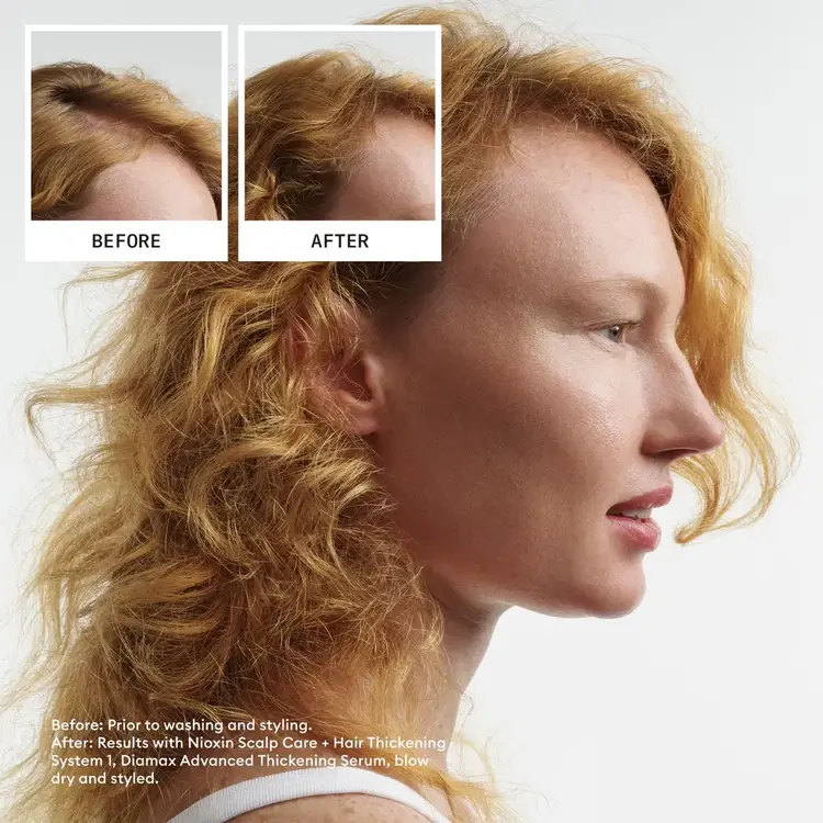 NIOXIN Pro Clinical NIOXIN - SYSTÈME | 1 Cheveux Naturels - Légèrement Clairsemés | KIT | Trousse d'Essaie