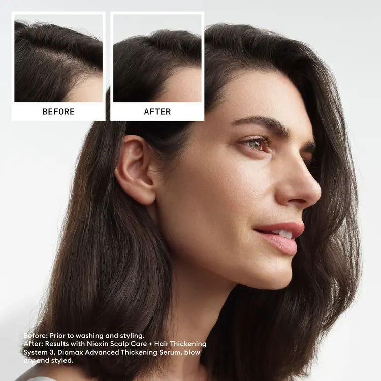 NIOXIN Pro Clinical NIOXIN - SYSTÈME | 3 Cheveux Colorés - Légèrement Clairsemés | KIT | Trousse de Départ