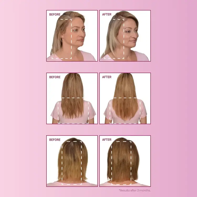 BOSLEY - MENDXTEND Ensemble de Départ. Système Fortifiant