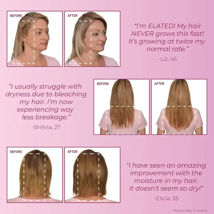 BOSLEY - MENDXTEND Ensemble de Départ. Système Fortifiant