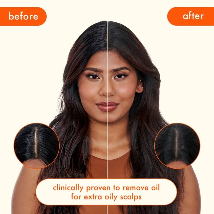 amika: Perk Up Ultra | Shampooing Sec Régulateur de Sébum – Nettoyage Express, Contrôle du Gras et Fini Propre Sans Résidu