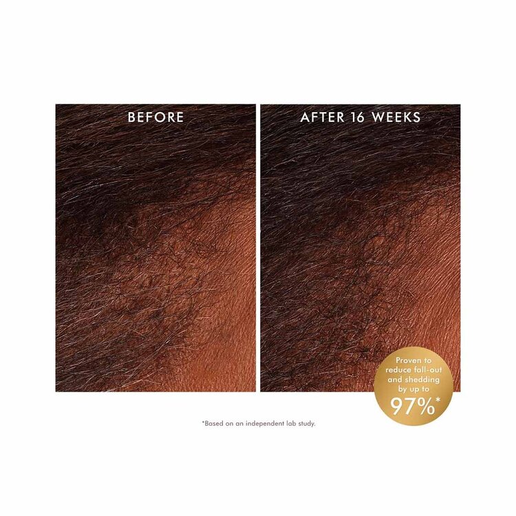 MOROCCANOIL Scalp | Tonique Revitalisant Cuir Chevelu 100 ml / 3.4 oz – Soin léger fraîcheur & confort