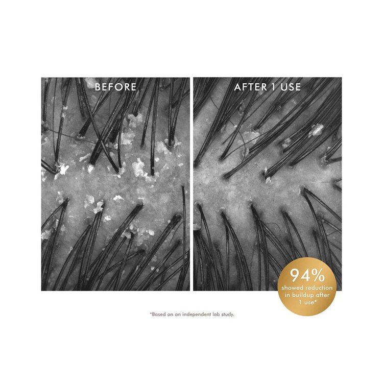 MOROCCANOIL Scalp | Purifying Scrub 125ml (4.2 oz) – Exfoliating detox for scalp