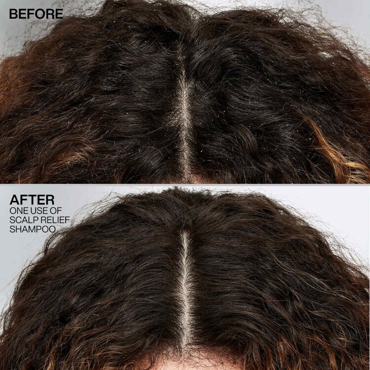 REDKEN Scalp Relief | Shampooing Antipelliculaire 250 ml
