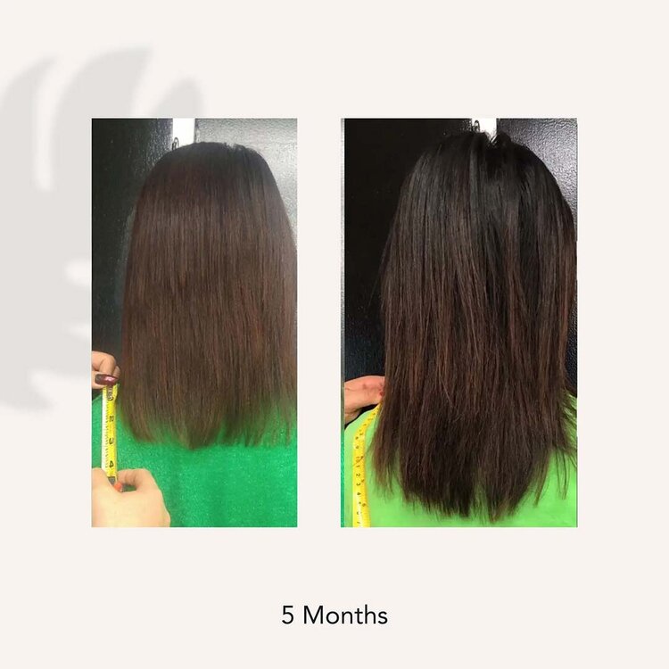 ACT/IV Renew | Après-Shampooing Soignant