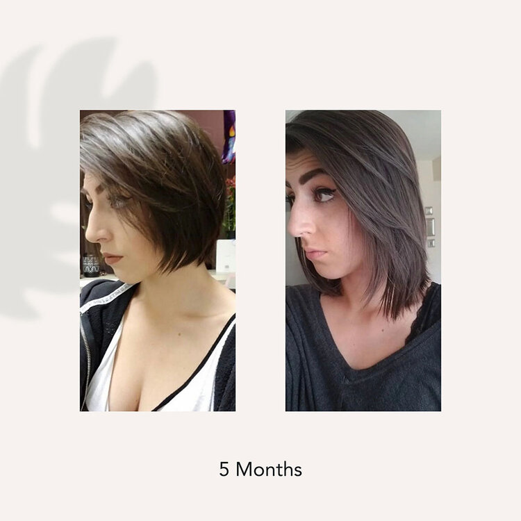 ACT/IV Renew | Après-Shampooing Soignant