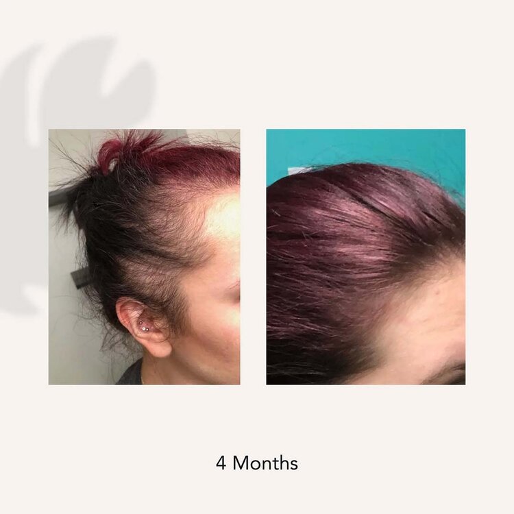 ACT/IV Recover | Women | Thickening Shampoo Treatment