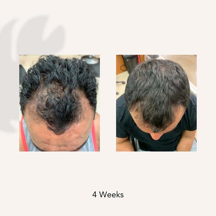 ACT/IV Recover | Men | Thickening Shampoo Treatment