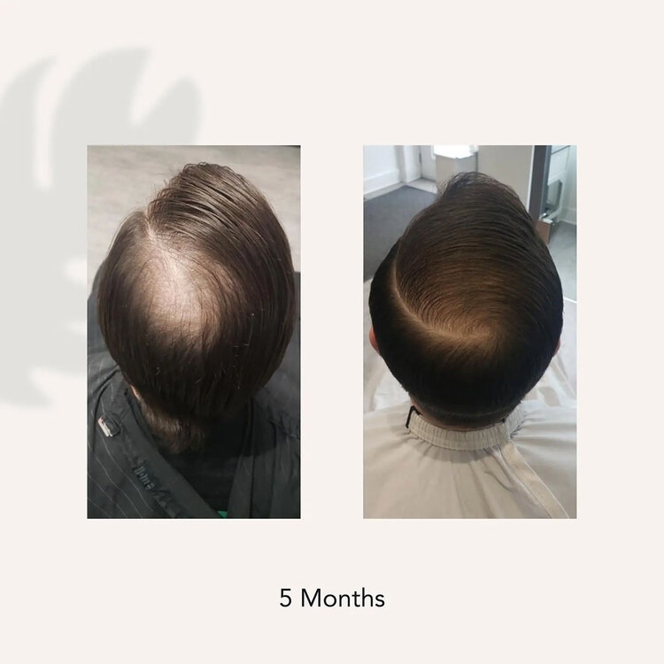 ACT/IV Recover | Men | Thickening Shampoo Treatment