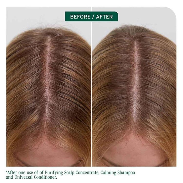 MATRIX Biolage | Scalp Sync | Concentré Purifiant pour Cuir Chevelu (200 ml / 6.8 oz) – Détox Précise et Rééquilibrante Avant-Shampooing