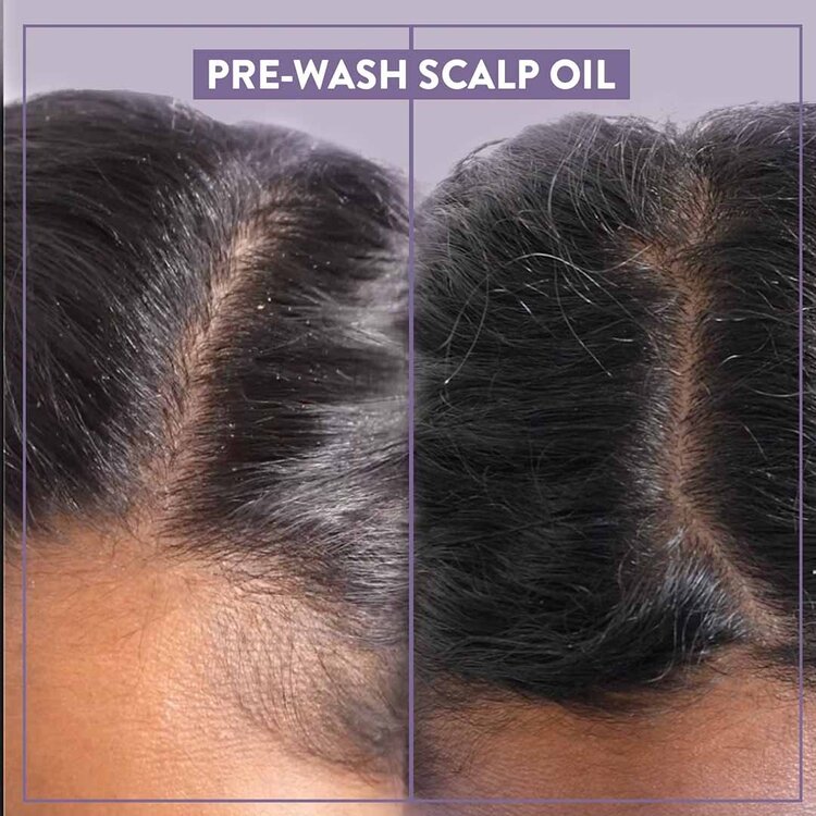 ALCÔVE Alcove | Scalp Pre-Wash Oil (35 ml / 1.2 oz) — Nurture your scalp with gentle care.