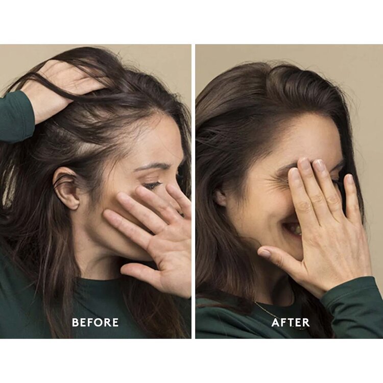 René FURTERER Paris René Furterer | Triphasic — Holiday Gift Set 2025 — Density, Strength & Revitalized Scalp