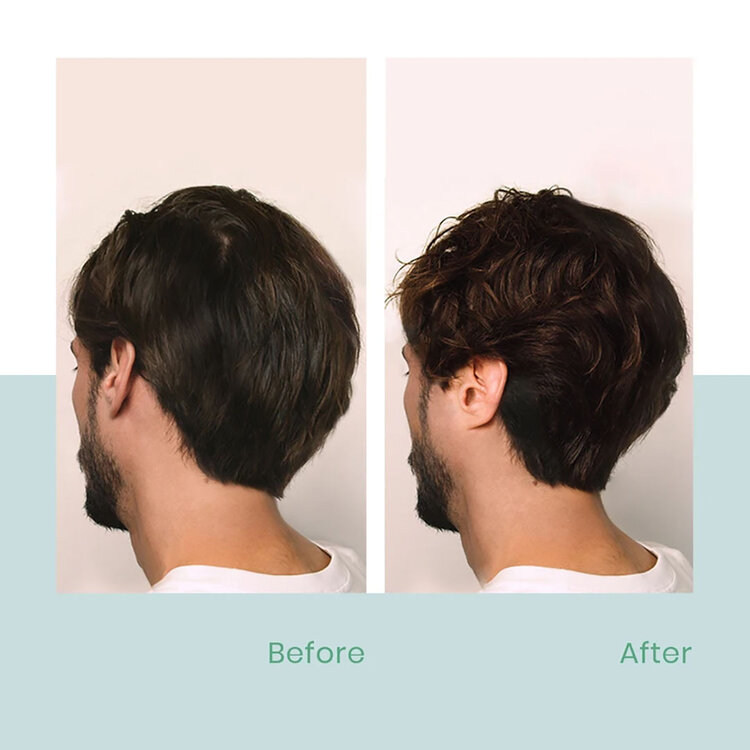 René FURTERER Paris René Furterer | Forticea — Holiday Gift Set 2025 — Energy, Strength & Vitality