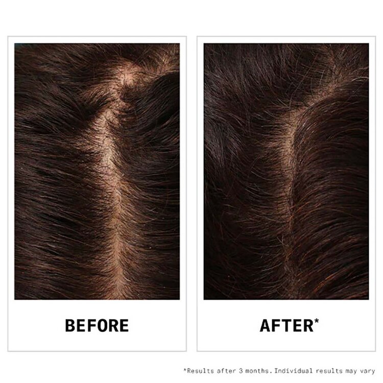 NIOXIN Pro Clinical Hair Fall Defense | Shampooing Renforçateur – Force et Densité des Cheveux