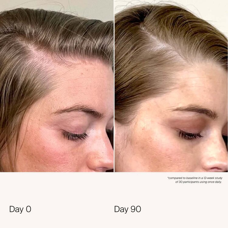 LIVING PROOF Scalp Care | Living Proof Density-Boosting Scalp Serum