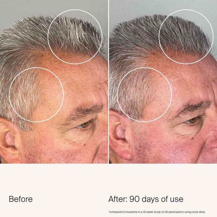 LIVING PROOF Scalp Care | Sérum Densité Revitalisant pour Cheveux Plus Épais