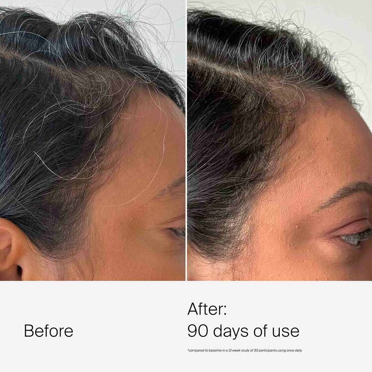 LIVING PROOF Scalp Care | Dry Scalp Treatment – Microbiome Balancing Treatment