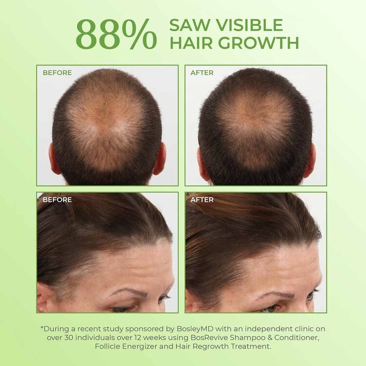 Scalp Follicle Energizer  – Thickening Scalp Treatment