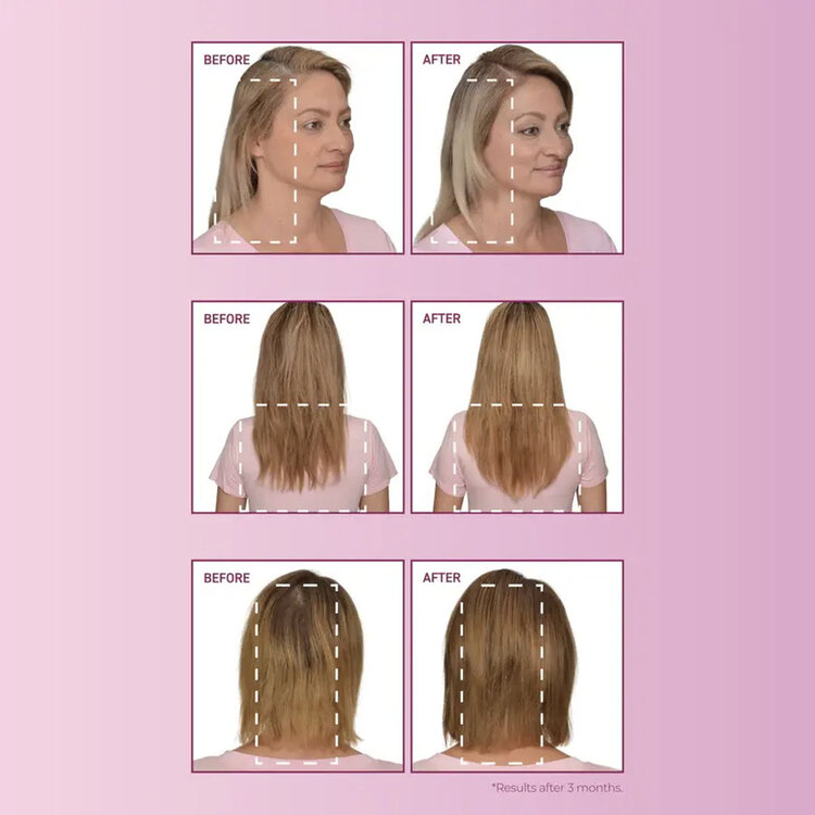 Mendxtend | Ensemble Renforcement des Systèmes - Routine complète fortifiante pour cheveux fragilisés