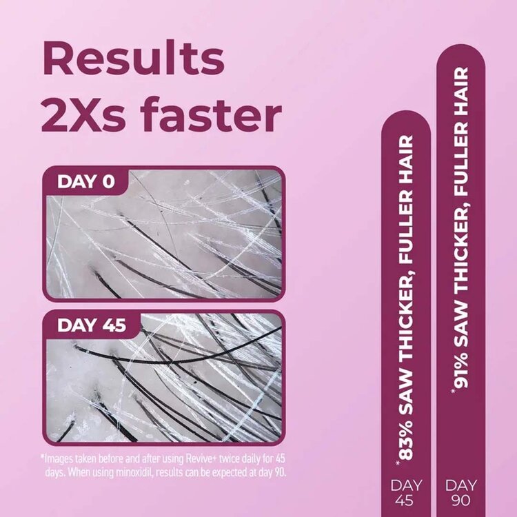 Revive+ | Women | Densifying Foam Treatment — Amplifies Hair Volume and Thickness