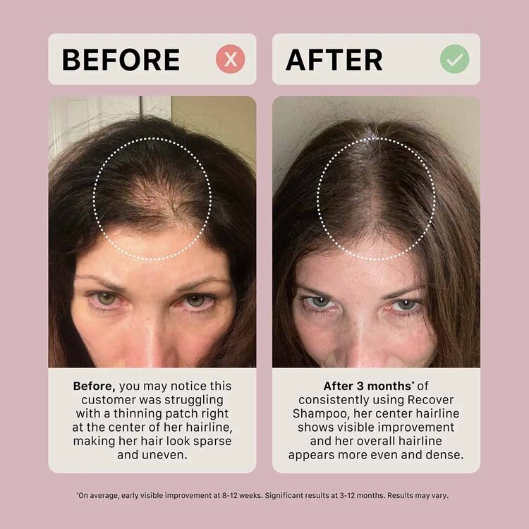 ACT/IV Recover | Spring Kit 2026 | Woman's Set - Complete Thickening Routine