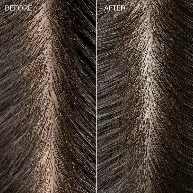 PAUL MITCHELL Tea Tree | Special Detox | Kombucha Rinse - Purifying Hair And Scalp Rinse
