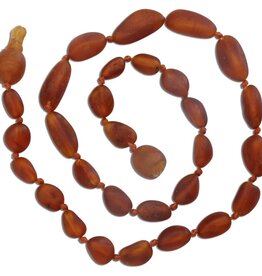 Cherished Moments Light Cherry Amber Teething Necklace