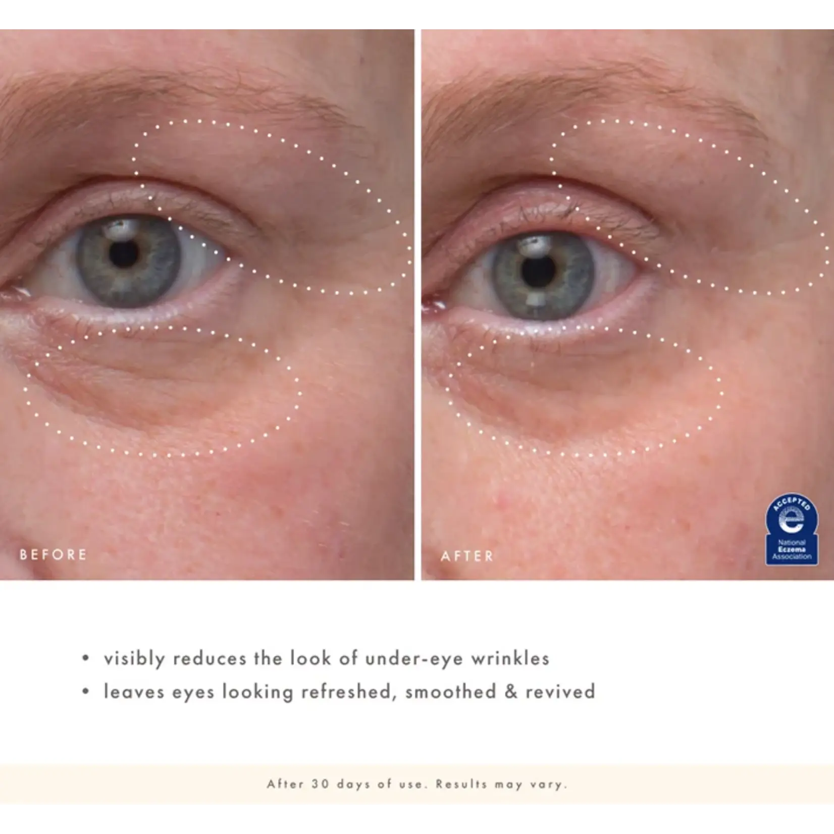 Farmhouse Fresh Eye'M Revived Total Renewal Cream