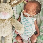 Premature Baby
