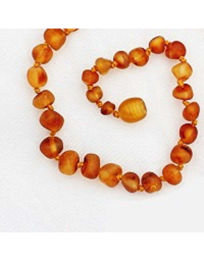 Healing Amber Bracelet/Anklet