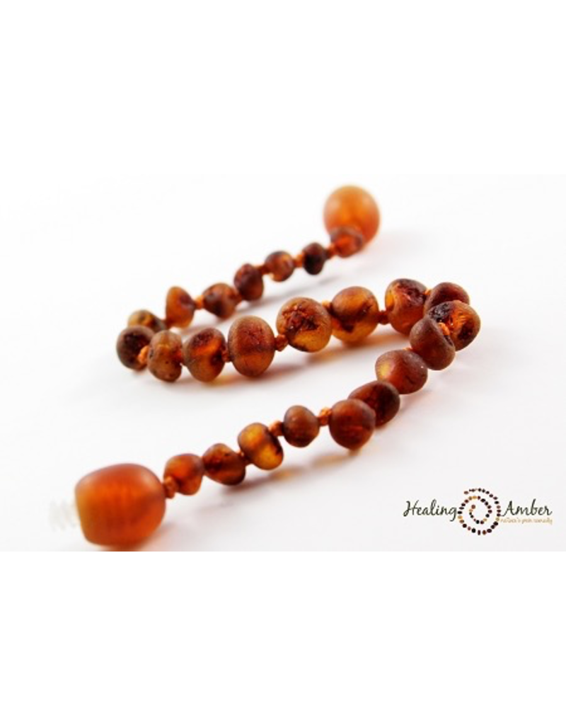 Large Healing Amber Necklace